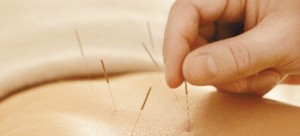 Safe, Natural Pain Relief with Acupuncture