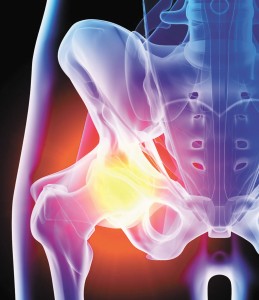 Joint Replacements and Modern Technologies