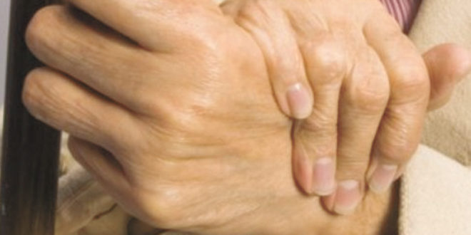 Living with Rheumatoid Arthritis? – South Florida Health and Wellness