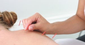 Acupuncture as Weight-Loss