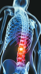 Freedom from Back Pain