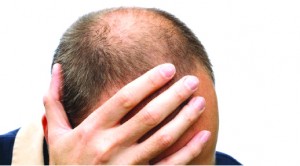 Top Six Reasons Why Your Hair Regrowth Treatments Aren’t Working