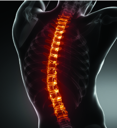 AVOID BACK AND SPINE SURGERIES!!!