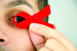 HIV AND THE EYES