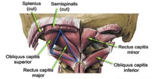 The Craniocervical Junction and headache disorders