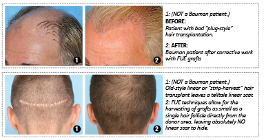 Bumann Medical Hair Restoration 