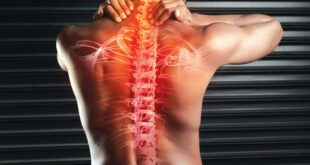 AVOID BACK AND SPINE SURGERIES!!!