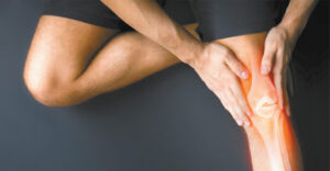 5 Reasons to Avoid Knee Replacement Surgery