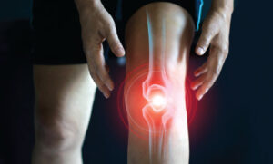 New Treatments For Knee Arthritis Now Available