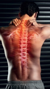Spinal Stenosis Pain