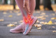 Radiation Therapy for Plantar Fasciitis