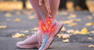 Radiation Therapy for Plantar Fasciitis